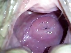 my asian girlfend's cute cervix in huge crevasse