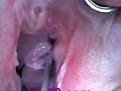 Cum Insertion with Injection Needle in Cervix Uterus after Fucking