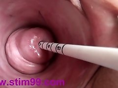 Extreme Real Cervix Fucking Injection Objects in Utherus