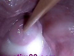 Insertion Sperm Cum in Cervix Wide Stretching Cum-hole Speculum