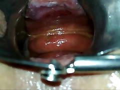 Inside me - anal speculum