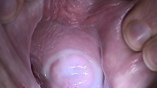 Sex gebärmutter Creampie Tube