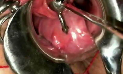 Video of female clitoris piecing - Porn tube